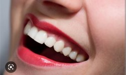 làm răng trắng đẹp 6 bí kíp để bạn đẹp hơn mỗi ngày diễn đàn.jpg
